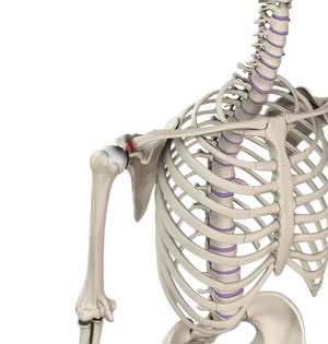 Acromioclavicular (AC) Joint Osteoarthritis