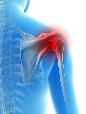 baseball-shoulder-injuries