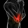 Lateral Impingement of the Elbow