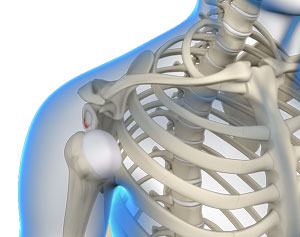 multidirectional-instability-of-the-shoulder